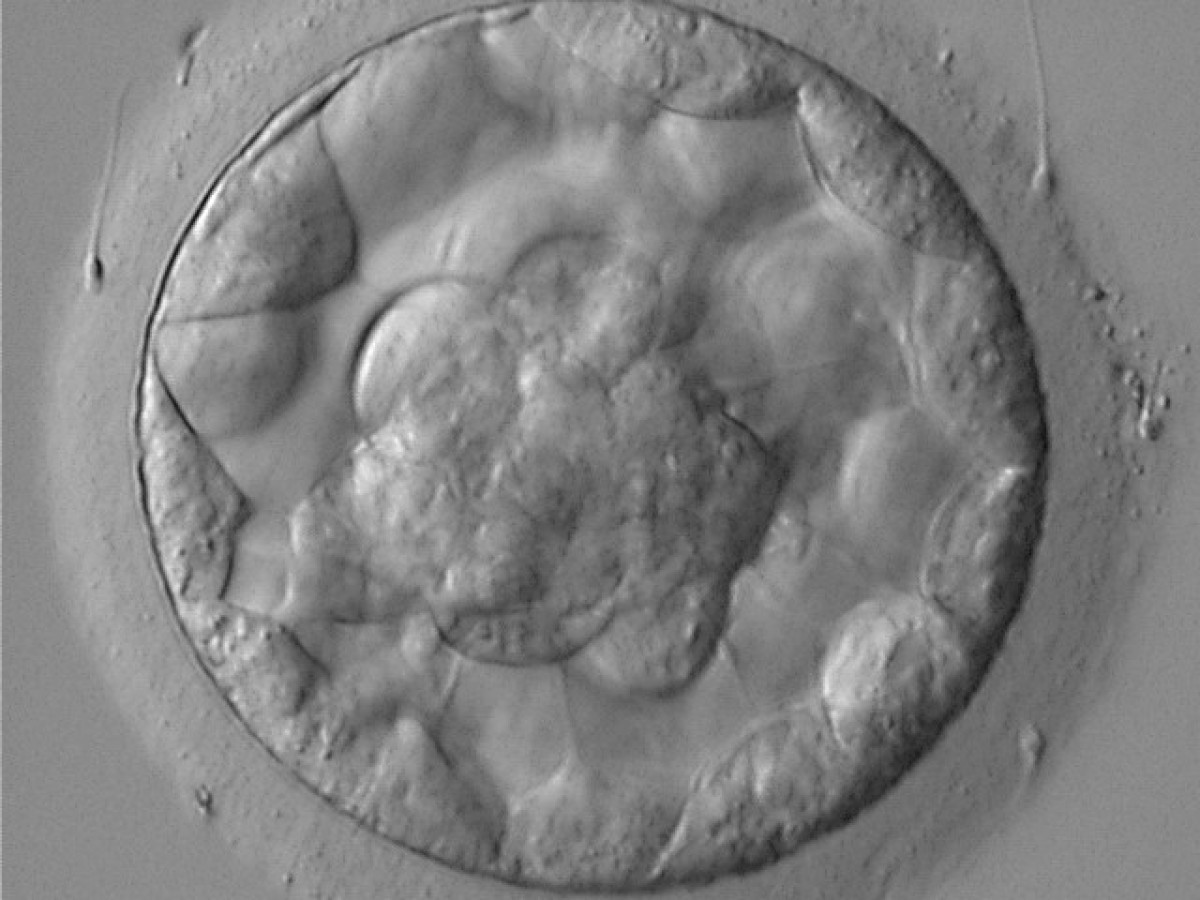 Voll entwickelte Blastozyste. Die zentral gelegene Zellanhäufung entspricht der Embryonalanlage