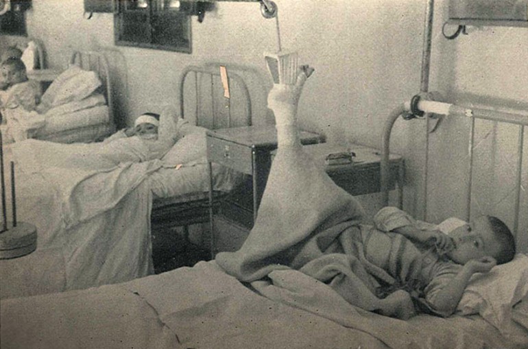 Die Opfer von Bomben waren oft Kinder: Die Opfer von Bomben waren oft Kinder